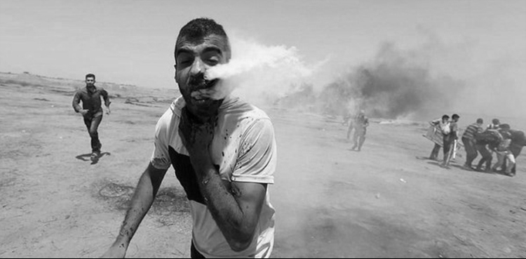 israeli-army-fired-on-the-face