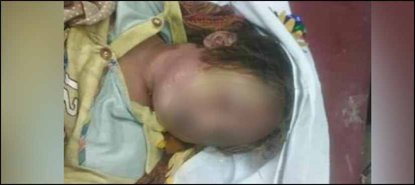 ایبٹ آباد : تیزرفتار جھولا گرنے سے ایک بچہ جاں بحق،11افراد زخمی ہوگئے