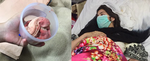 لاہورکے سروسزاسپتال نے مریضہ کو تختہ مشق بنادیا