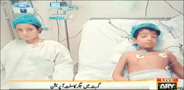 جگر کی پیوند کاری سندھ کے اسپتال میں ممکن، بالکل مفت ٹرانسپلانٹ کا کامیاب تجربہ