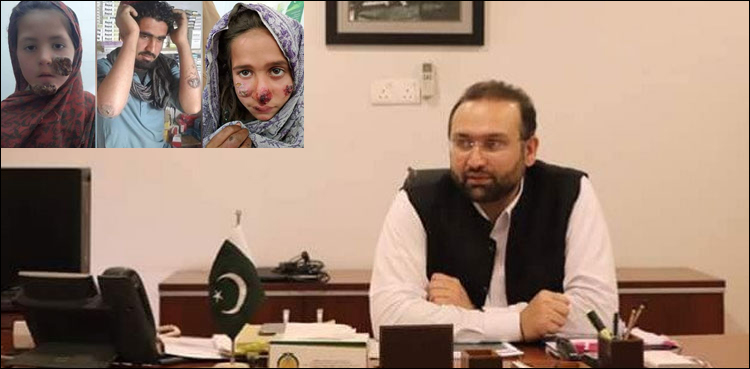 لشمینیا خطرناک بیماری نہیں، ادویات نہ ہونے کی وجہ سے مشکلات کا سامنا ہے، وزیر صحت خیبرپختونخوا