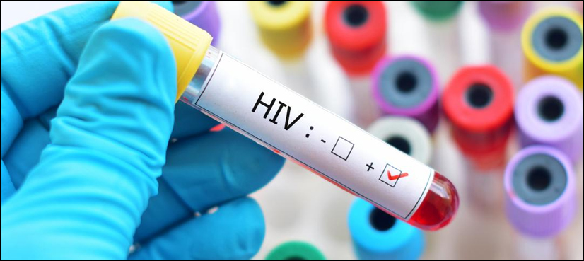 لاڑکانہ: ایچ آئی وی اسکریننگ کا 18 واں روز، تعداد 534 ہو گئی