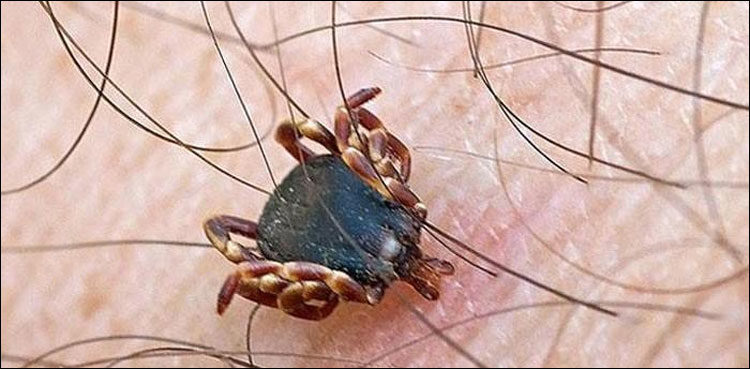 احتیاطی تدابیر اپنا کر کانگو بخار سے بچا جاسکتا ہے، ڈاکٹر نوید اختر