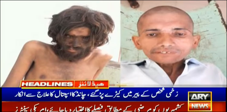 لاڑکانہ: بھٹو کے شہر میں زخمیوں سے برا سلوک، زخموں میں کیڑے پڑ گئے