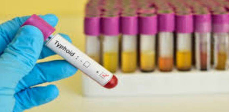 ٹائیفائیڈ: ویکسین کی تیاری اور طبی جانچ کا طریقہ کیا ہے؟