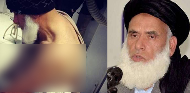 مفتی کفایت اللہ اور ان کے بیٹوں پر حملہ