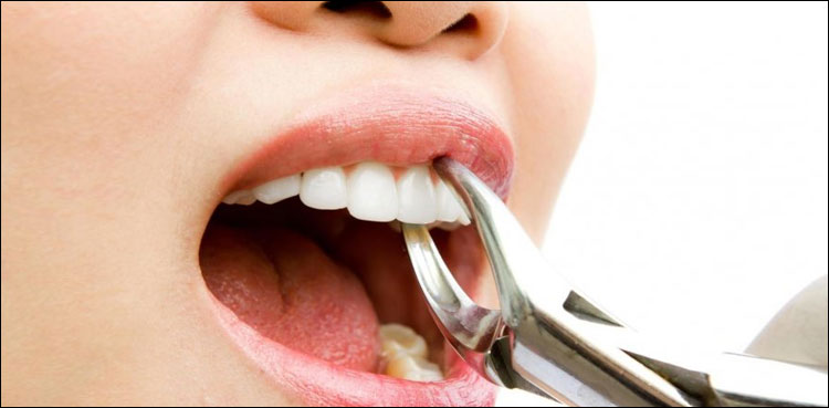 دانتوں کے ڈاکٹر کی عجیب حرکت اسے مہنگی پڑ گئی