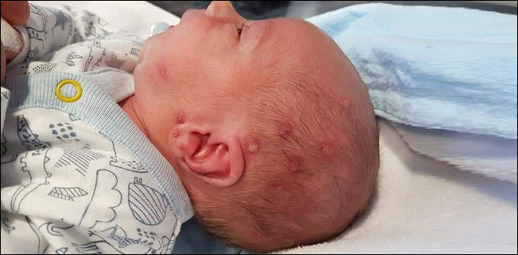 نوزائیدہ بچے کو چومنا موت کے منہ میں‌ لے گیا