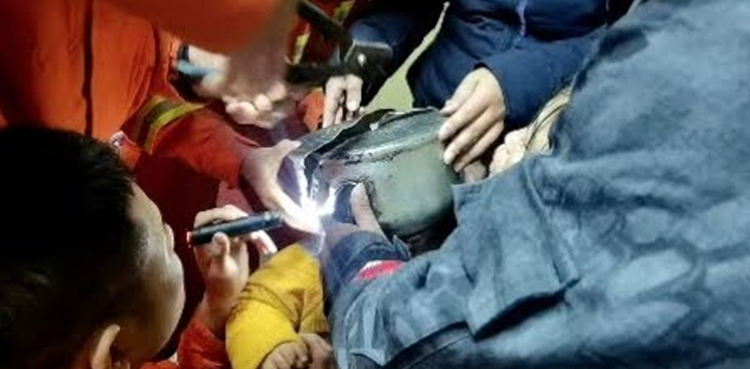 کیتلی کاٹ کر بچے کا سر نکال لیا