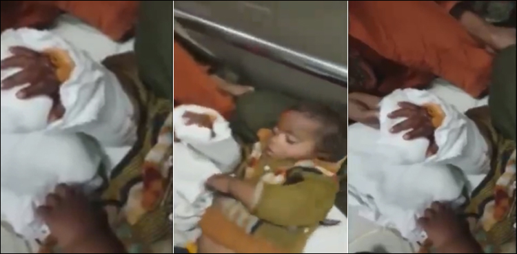 پاکستانی ڈاکٹرز کا بڑا کارنامہ، بچے کا کٹا ہاتھ جوڑ دیا