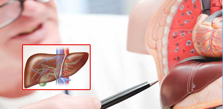انسانی جگر: سروسس کیا ہے؟
