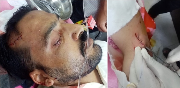 مری میں خوں خوار چیتے نے موٹر سائیکل سواروں پر حملہ  کر دیا، زخمیوں کی شدید مزاحمت