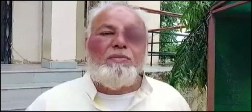 انتہا پسند ہندوؤں کا مسلمان رکشہ ڈرائیور پر بہیمانہ تشدد، داڑھی کے بال نوچ لیے