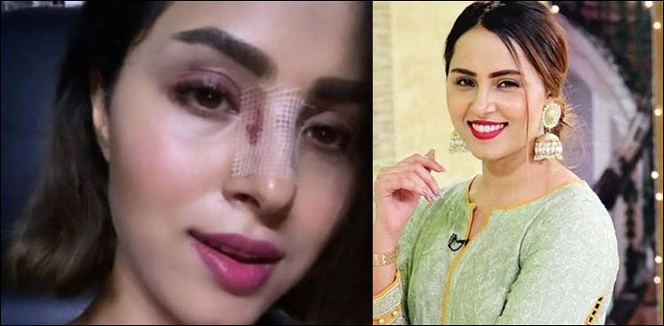 اداکارہ نمرہ خان سیڑھیوں سے گر کر زخمی ہوگئیں