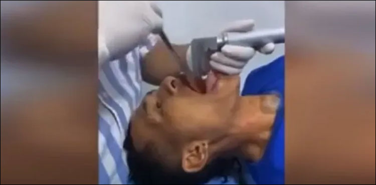 مریض کے حلق سے 7 انچ طویل مچھلی نکالنے کی سرجری، ویڈیو وائرل