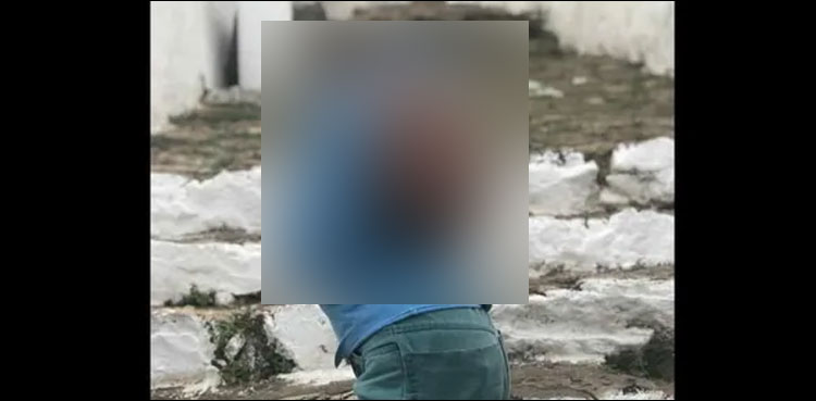 قدرت کا معجزہ: الٹے سر کے ساتھ پیدا ہونے والا بچہ کتنا بڑا ہوگیا؟