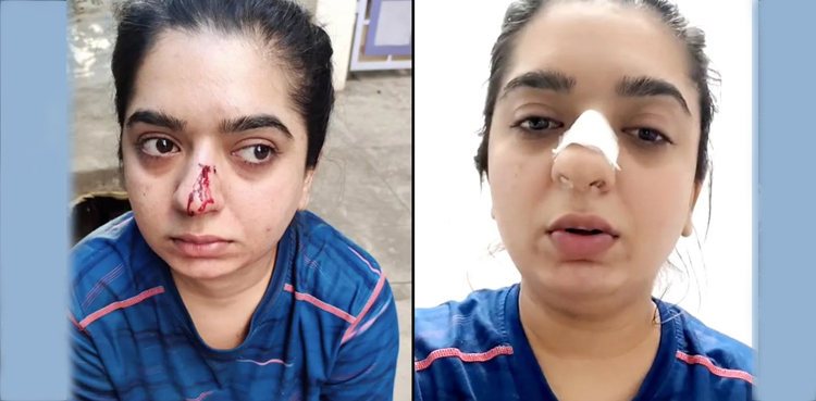 ڈلیوری بوائے نے خاتون کی ناک توڑ دی، ویڈیو وائرل