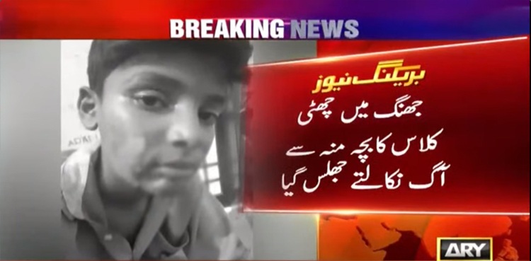 ٹیچر کے کہنے پر منہ سے آگ لگانے کی پریکٹس : بچہ جھلس گیا، مقدمہ درج