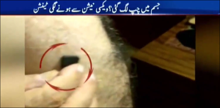 کرونا ویکسی نیشن کے ذریعے جسم میں چپ داخل کرنے کا پروپیگنڈا، حقیقت سامنے آگئی