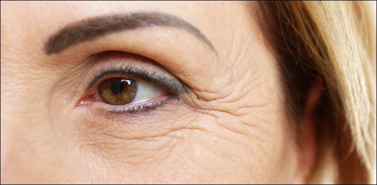 کم عمری میں ہی نمایاں ہوتی جھریوں سے کیسے بچا جائے؟
