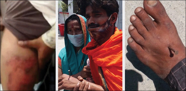 بھارت: نوجوان کے ہاتھ پیروں میں کیلیں ٹھونک دی گئیں