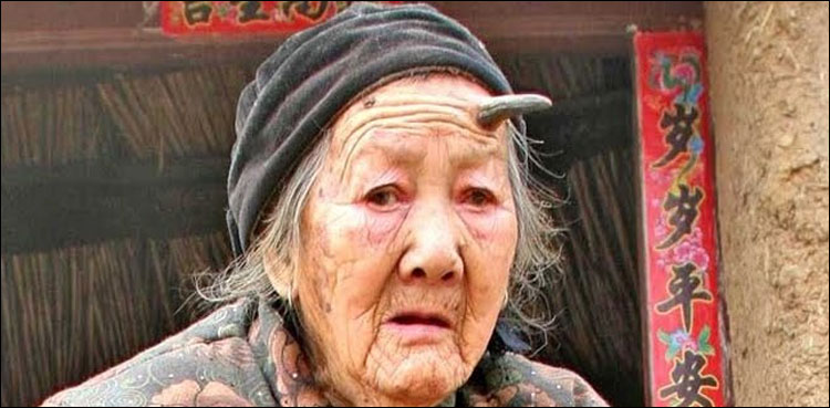 کیا انسانوں کے سر پر بھی سینگ ہوتے ہیں؟