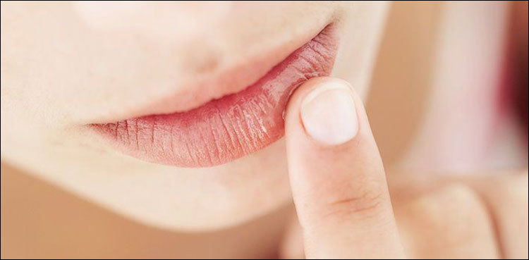 خشک اور سیاہ ہونٹوں سے نجات پانے کا طریقہ