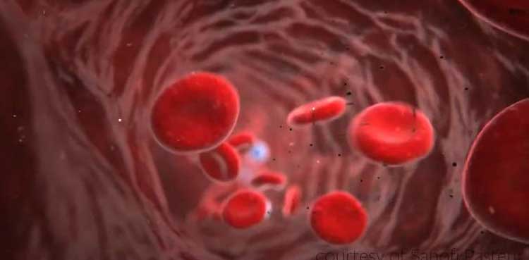 تشویشناک صورتحال ،  ڈینگی وائرس جگر کو بھی متاثر کرنے لگا