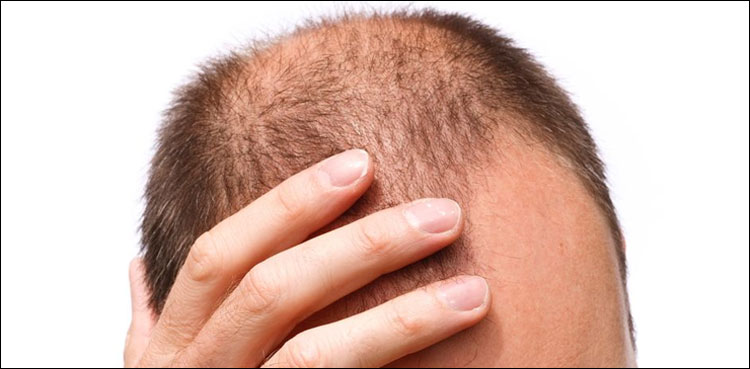 مرد گنج پن سے کیسے بچ سکتے ہیں؟