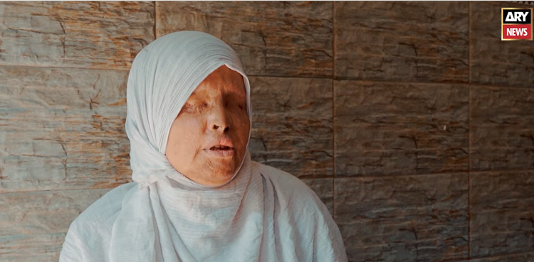 بیٹیوں نے میری ہمت کو ٹوٹنے نہیں دیا، تیزاب گردی کی شکار خاتون