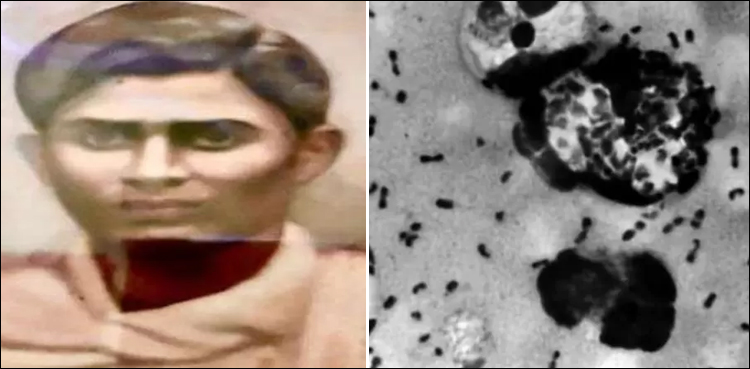 ریلوے اسٹیشن پر کھڑے شخص کی اچانک موت اور طاعون کا انجیکشن