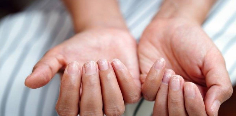 جسم میں آئرن کی کمی معلوم کرنے کے 5 آسان طریقے