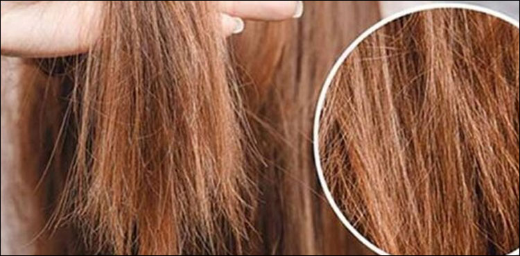سردیوں میں بالوں کو ٹوٹنے سے بچانے کے طریقے