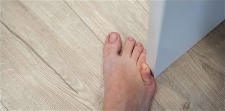 پاؤں کی چھوٹی انگلی کسی چیز سے ٹکرانے پر شدید تکلیف کیوں ہوتی ہے؟