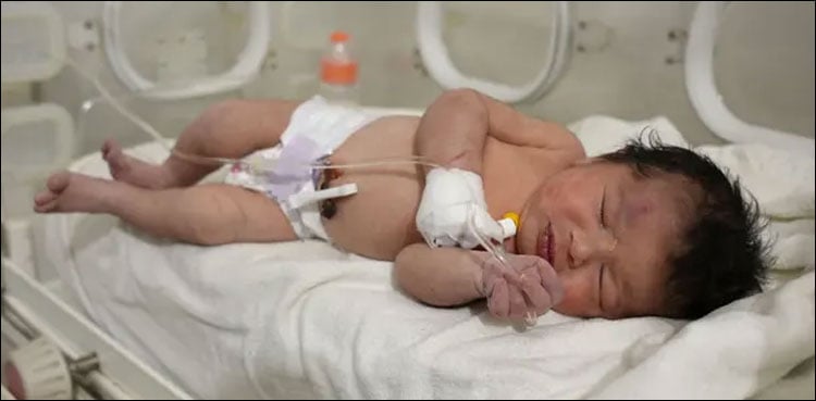 ملبے میں پیدا ہونے والی شامی بچی کا نام کیا رکھا گیا؟