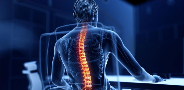 ریڑھ کی ہڈی زندگی کی ضامن، اس کا خیال کیسے رکھا جائے؟