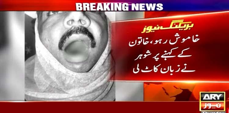 خاموش رہو، بیوی کے کہنے پر شوہر نے زبان کاٹ لی