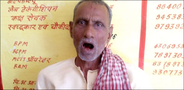 گھٹنے کے درد سے نجات کے لیے شہری نے زبان کاٹ دی