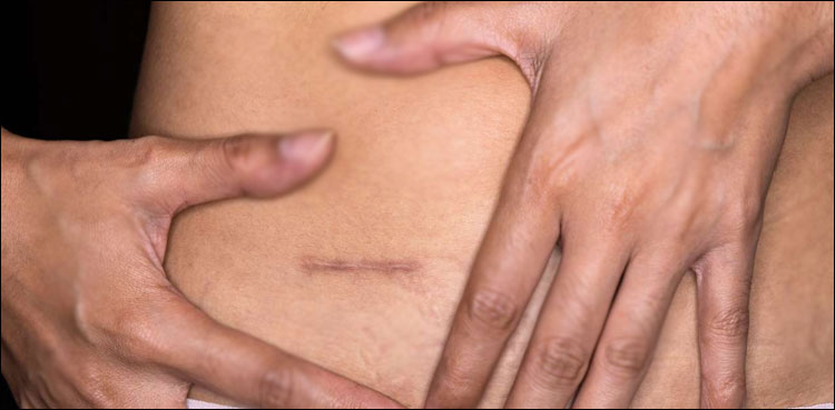صحت کارڈ سے ڈاکٹر نے سال میں 773 اپنڈکس آپریشن کر ڈالے، تحقیقات شروع