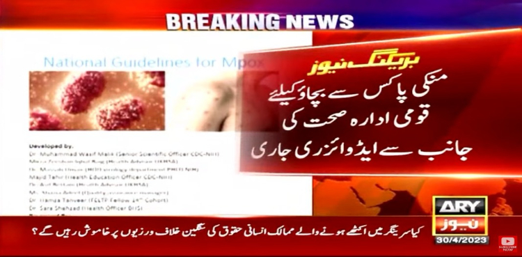 منکی پاکس سے بچاؤ کیلئے ایڈوائزری جاری