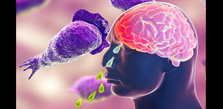 انسانی دماغ کو کھانے والا ’نگلیریا‘ کیا ہے؟ جانیے!