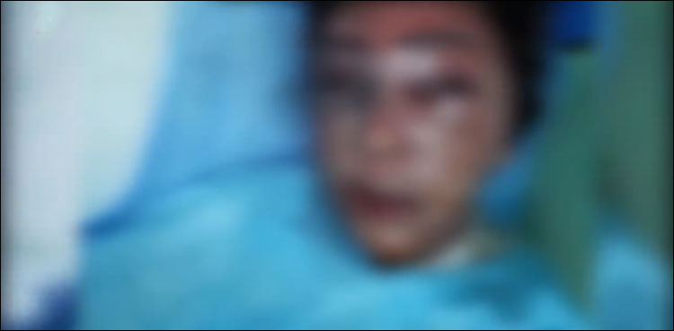 عراق میں ساس نے حاملہ بہو پر پیٹرول چھڑک کر آگ لگا دی