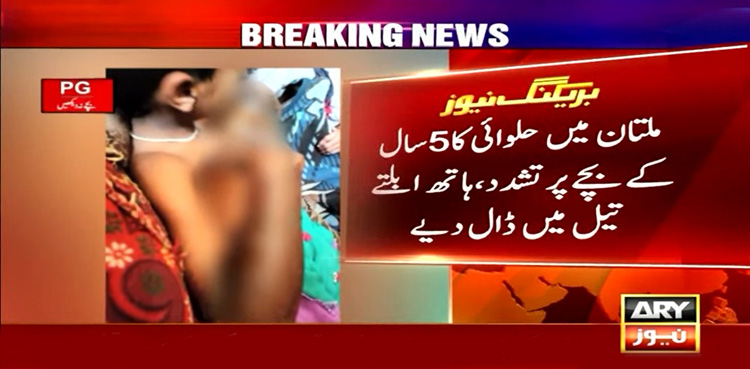 محنت کش بچے پر بہیمانہ ظلم، ہاتھ کھولتے ہوئے تیل میں ڈال دیے