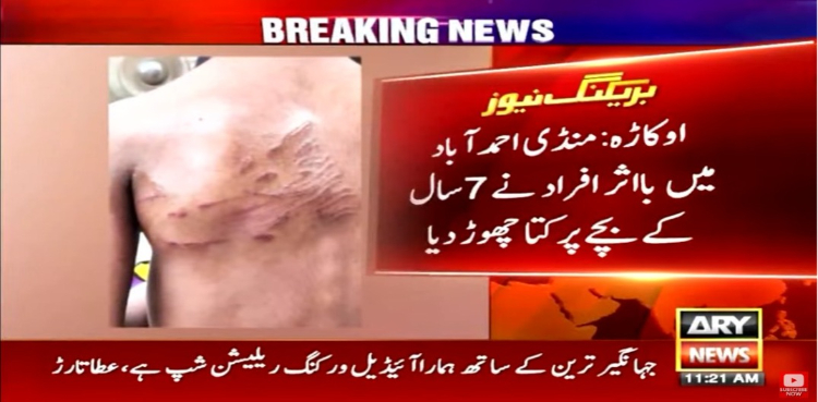 اوکاڑہ میں بااثر افراد نے 7 سالہ بچے پر کتا چھوڑ دیا