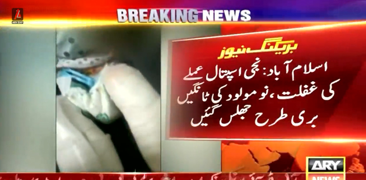 نجی اسپتال کے عملے کی غفلت: انکیوبیٹر میں رکھی  نومولود بچی کی دونوں ٹانگیں ضائع ہوگئیں