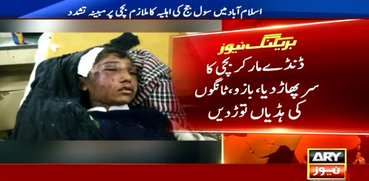 جج کی اہلیہ کے مبینہ تشدد سے زخمی بچی کی حالت تشویشناک