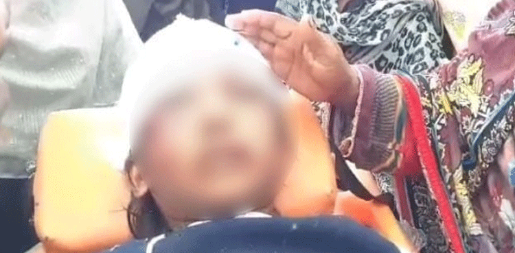 تشدد کا شکار 14 سالہ گھریلو ملازمہ رضوانہ کی طبعیت پہلے کی نسبت بہتر