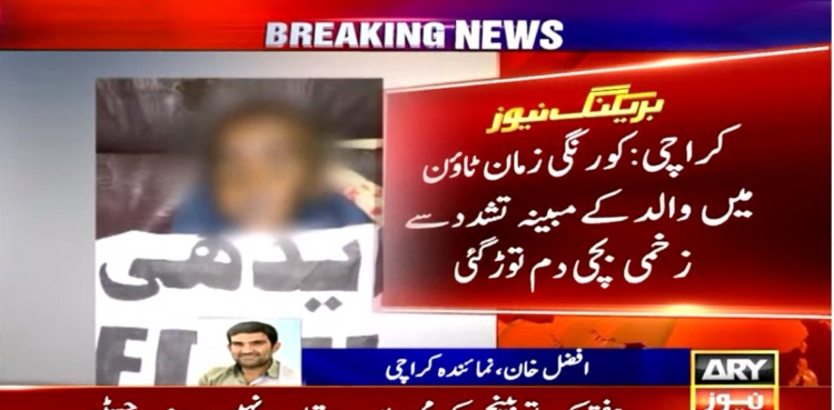 زیادہ بھیک مانگنے کیلئے باپ نے بیٹی کو جلا دیا لیکن وہ جانبر نہ ہو سکی