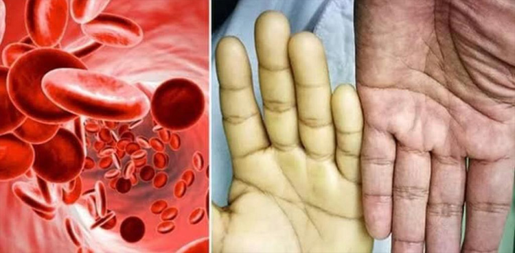 جسم میں آئرن کی کمی کو کیسے پورا کیا جائے؟