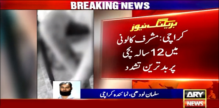 کمسن بچی پر سوتیلی ماں کا بدترین تشدد، گرم سلاخوں سے داغا